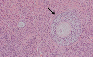 Two ovarian follicles at different stages of maturation (primary on the left, secondary on the right).