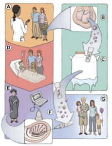 An illustration describing fertility preservation in prepubertal cancer patients